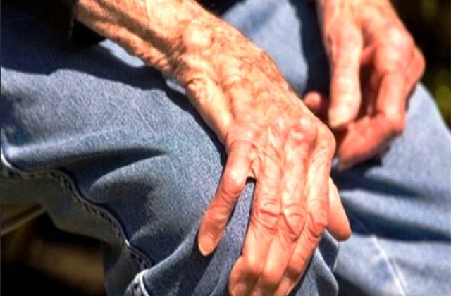 Kemik Erimesinden Korunmanın Yolları