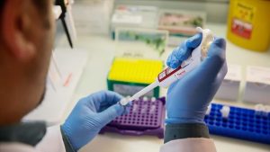 Türkiye Hemofili Derneği Yönetim Kurulu Başkanı Prof. Dr. Zülfikar, nadir